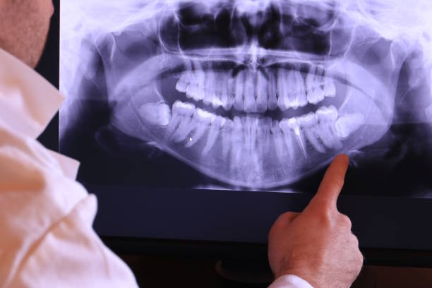 Best Emergency Dental Surgery in South Hooksett, NH
